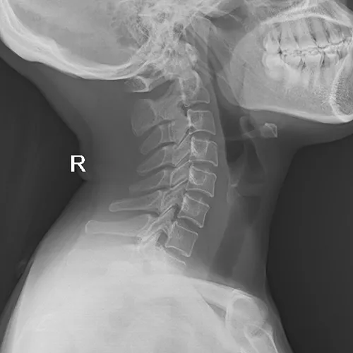Head radiograph