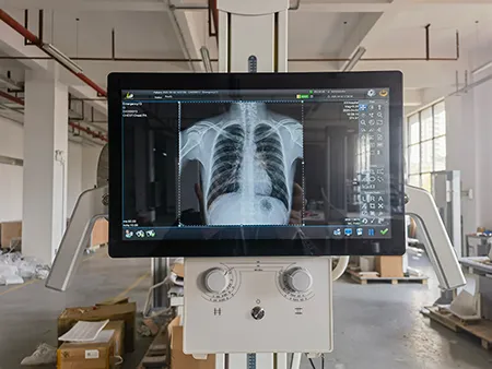 SHO-DDX05 Floor-mounted Digital X-ray Machine